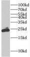 RAB9A, Member RAS Oncogene Family antibody, FNab07048, FineTest, Western Blot image 