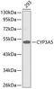 Cytochrome P450 Family 3 Subfamily A Member 5 antibody, 15-017, ProSci, Western Blot image 