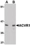 Activin A Receptor Type 1 antibody, PA5-20604, Invitrogen Antibodies, Western Blot image 