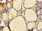 Zinc Finger Matrin-Type 4 antibody, orb357719, Biorbyt, Immunohistochemistry paraffin image 