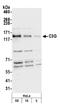 Ras Protein Specific Guanine Nucleotide Releasing Factor 2 antibody, NBP1-06500, Novus Biologicals, Western Blot image 