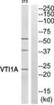 Vesicle Transport Through Interaction With T-SNAREs 1A antibody, TA316137, Origene, Western Blot image 