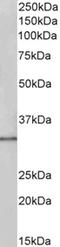 Nephrocystin 1 antibody, orb314716, Biorbyt, Western Blot image 