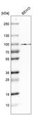 Protein-glutamine gamma-glutamyltransferase K antibody, HPA040171, Atlas Antibodies, Western Blot image 