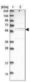 Chromosome 17 Open Reading Frame 53 antibody, NBP1-93494, Novus Biologicals, Western Blot image 