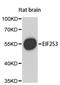 Eukaryotic Translation Initiation Factor 2 Subunit Gamma antibody, A3848, ABclonal Technology, Western Blot image 