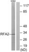 Replication protein A 32 kDa subunit antibody, abx012821, Abbexa, Western Blot image 