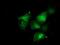 BCAR1 Scaffold Protein, Cas Family Member antibody, NBP2-00532, Novus Biologicals, Immunocytochemistry image 