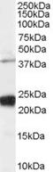LIM Domain 7 antibody, orb18591, Biorbyt, Western Blot image 