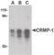 Collapsin Response Mediator Protein 1 antibody, LS-C19541, Lifespan Biosciences, Western Blot image 