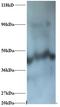 NADH:Ubiquinone Oxidoreductase Subunit A1 antibody, LS-C210898, Lifespan Biosciences, Western Blot image 