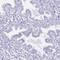 Uroplakin 1A antibody, HPA049879, Atlas Antibodies, Immunohistochemistry paraffin image 