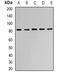 Acylaminoacyl-Peptide Hydrolase antibody, orb340993, Biorbyt, Western Blot image 