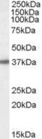 3'(2'), 5'-Bisphosphate Nucleotidase 1 antibody, GTX89004, GeneTex, Western Blot image 