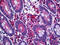 LIM Domain Kinase 1 antibody, 51-726, ProSci, Immunohistochemistry paraffin image 