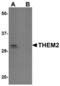 Acyl-CoA Thioesterase 13 antibody, MBS150103, MyBioSource, Western Blot image 