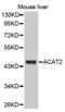 ACAT-2 antibody, MBS126807, MyBioSource, Western Blot image 