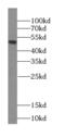 RB Binding Protein 4, Chromatin Remodeling Factor antibody, FNab07150, FineTest, Western Blot image 