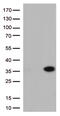 Nicotinamide Riboside Kinase 2 antibody, TA813058S, Origene, Western Blot image 