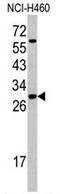 Serine And Arginine Rich Splicing Factor 5 antibody, AP17743PU-N, Origene, Western Blot image 