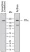 Pcp2 antibody, MA5-24368, Invitrogen Antibodies, Western Blot image 