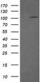 DExD/H-Box Helicase 58 antibody, TA506202BM, Origene, Western Blot image 