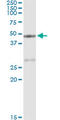 Carboxypeptidase A1 antibody, LS-C196955, Lifespan Biosciences, Immunoprecipitation image 
