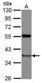 Proteasome 26S Subunit, Non-ATPase 8 antibody, GTX101613, GeneTex, Western Blot image 