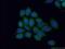 Ankyrin repeat domain-containing protein 2 antibody, 11821-1-AP, Proteintech Group, Immunofluorescence image 