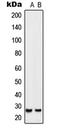 Homeobox protein SIX6 antibody, LS-C352609, Lifespan Biosciences, Western Blot image 