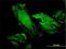 Ribosomal Protein S7 antibody, H00006201-M03, Novus Biologicals, Immunofluorescence image 
