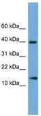 ATPase H+ Transporting V1 Subunit G2 antibody, TA344635, Origene, Western Blot image 
