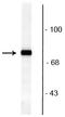 Rabphilin 3A antibody, P10247, Boster Biological Technology, Western Blot image 
