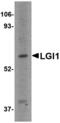 Leucine Rich Glioma Inactivated 1 antibody, MBS151464, MyBioSource, Western Blot image 