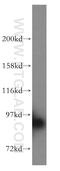 Signal Transducer And Activator Of Transcription 5B antibody, 51072-2-AP, Proteintech Group, Western Blot image 