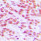 H2A Histone Family Member X antibody, LS-C352308, Lifespan Biosciences, Immunohistochemistry paraffin image 