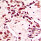 Lamin A/C antibody, LS-C352468, Lifespan Biosciences, Immunohistochemistry paraffin image 