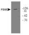 Amyloid beta A4 precursor protein-binding family B member 1 antibody, TA301423, Origene, Western Blot image 