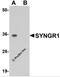 Synaptogyrin-1 antibody, 5563, ProSci Inc, Western Blot image 