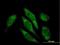 Aldehyde Dehydrogenase 16 Family Member A1 antibody, H00126133-B01P, Novus Biologicals, Immunocytochemistry image 