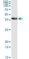Protein FRG1 antibody, H00002483-M01, Novus Biologicals, Immunoprecipitation image 