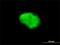 Dephospho-CoA Kinase Domain Containing antibody, H00079877-M02, Novus Biologicals, Immunofluorescence image 
