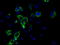 Aconitase antibody, TA500873, Origene, Immunofluorescence image 