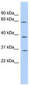 Coiled-Coil Domain Containing 54 antibody, TA344269, Origene, Western Blot image 