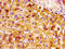Netrin 1 antibody, CSB-PA016127LA01HU, Cusabio, Immunohistochemistry paraffin image 