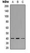 C-C chemokine receptor type 11 antibody, orb235066, Biorbyt, Western Blot image 