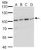 DNA Cross-Link Repair 1C antibody, NBP2-15477, Novus Biologicals, Western Blot image 