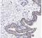 Cadherin-3 antibody, NBP1-85707, Novus Biologicals, Immunohistochemistry paraffin image 