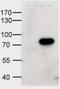 ATP Binding Cassette Subfamily D Member 1 antibody, MBS420795, MyBioSource, Western Blot image 