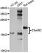 Uncharacterized protein C5orf52 homolog antibody, abx125467, Abbexa, Western Blot image 